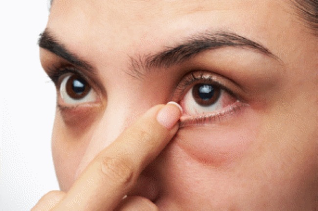Le glaucome : une maladie oculaire désagréable